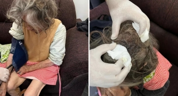 Filho é preso suspeito de maus-tratos a idosa encontrada com larvas na cabeça, em Goiânia